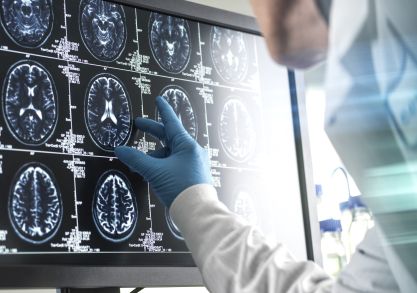 Aufnahme menschliches Gehirn Scan