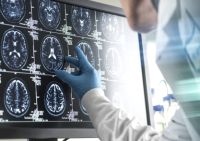 Aufnahme menschliches Gehirn Scan
