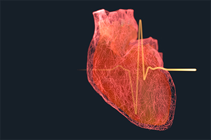 Fortschritt in der Therapie von lebensbedrohlichen Herzrhythmusst&ouml;rungen